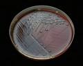 pneumococcus on blood agar, appearance of colonies